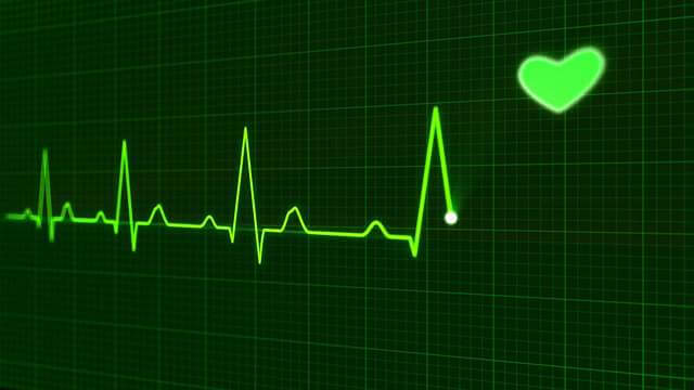 cardiac-monitoring