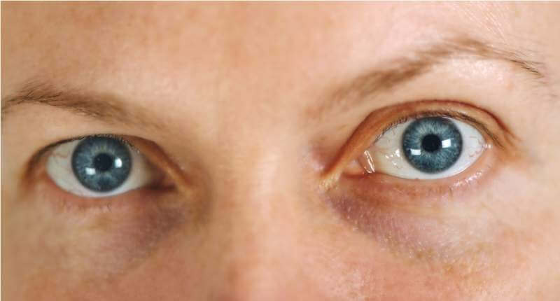 blue-adult-female-eyes-without-make-up