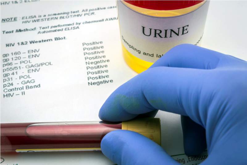 tests-for-research-of-urine