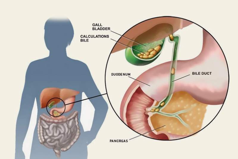 unhealthy-for-health